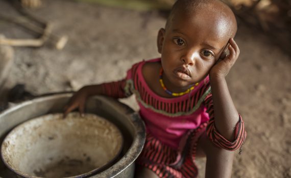 What is the difference between hunger, famine and malnutrition?