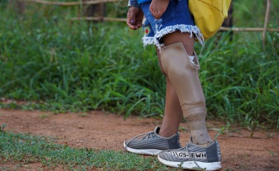 Empowered families bring new hope for children with disability